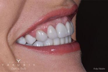 Yakubiv Dental