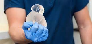 CHANGEMENT OU RETRAIT DE PROTHÈSES Chirurgie Plastique Esthetique Smile Infinity Abidjan