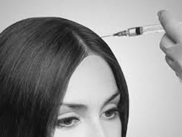 Woman receiving scalp injection.