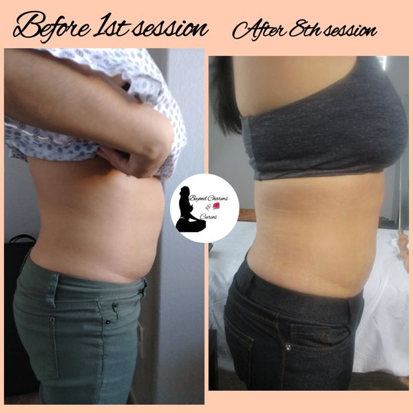 Non-Invasive Body Sculpting.