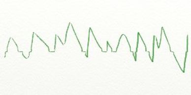 Alpha Brain Waves Healing Hypnosis Sue Schmidt C.Ht, Hypnotherapy