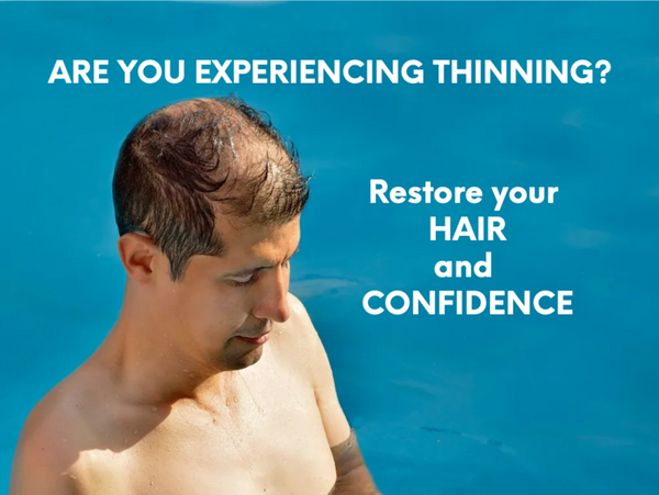 man experiencing hair loss