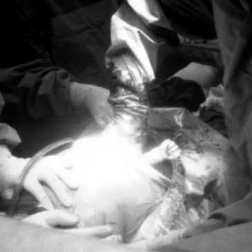 Reaching for the stars! ( A real picture of my grandson's hand during his c-section!)