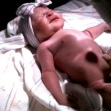 Baby girl with her giant bow about to say hello to the world.