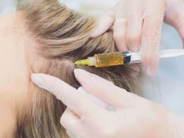 A doctor is injecting medicine into hair