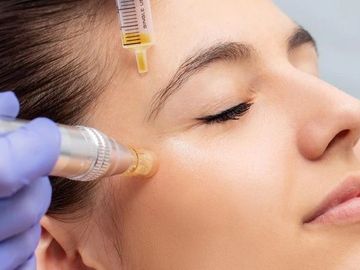 A woman is taking PRP facial for glowing skin
