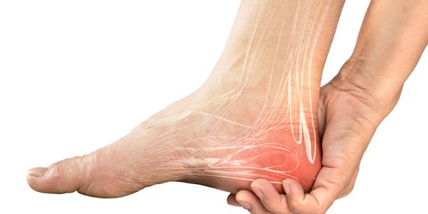 Foot Pain, Plantar Fasciitis, Heel Pain, Achilles tendonitis, cuboid syndrome, Foot Physical Therapy