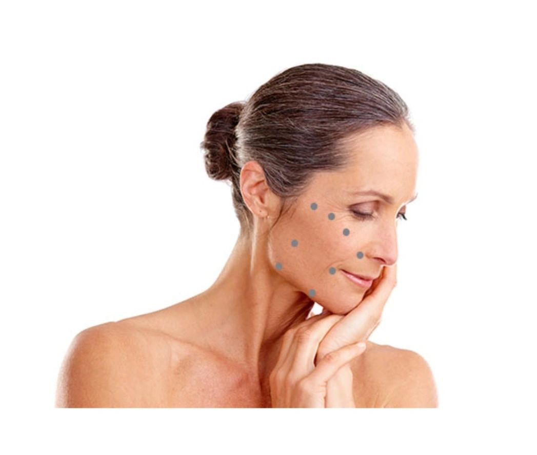 Skin boosters Croydon