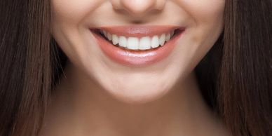 Sbiancamento dentale Centro Sanident Salerno