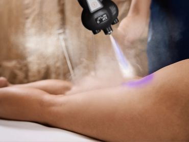 A person receiving cryotherapy treatment on the thigh with a cold spray device.