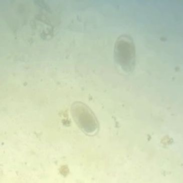 Microscopic view of oval-shaped microorganisms in a light-colored medium.