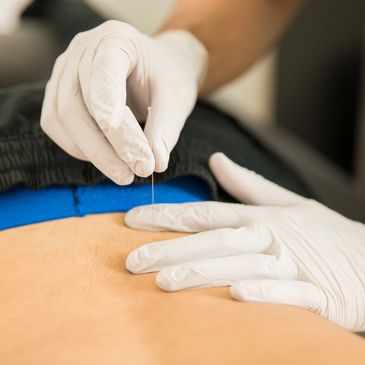Best Acupuncture Reno Nevada