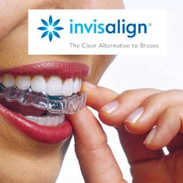 Highly rated invisalign provider, you can get your confident smile now and pay later with finance.