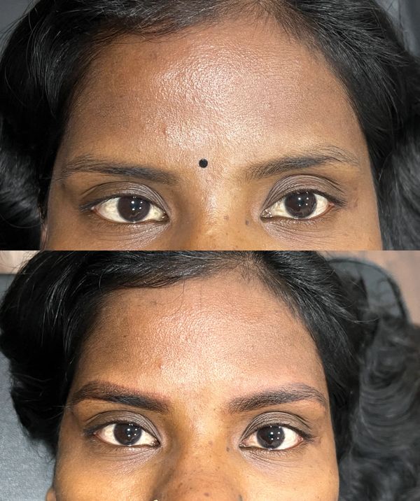 before and after effect of powder brows (brow micropigmentation)