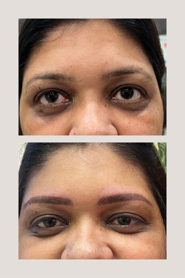 before and after effect of micro blading (brow micropigmentation)