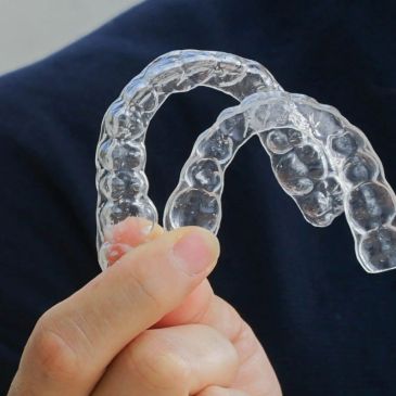 Alineadores usados en ortodoncia invisible
Invisaling. keepsmiling.