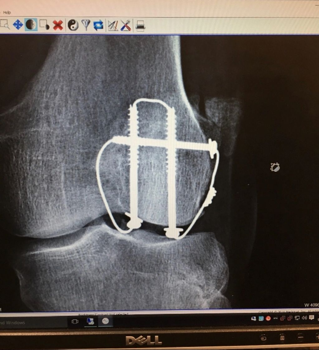 Werner changed my life