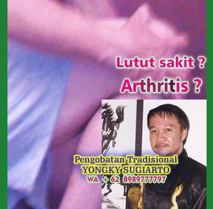 Pengobatan Osteoarthritis