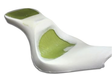 Detailed cross-section of a bone showing green marrow inside.