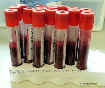Blood samples clotting in a container to hold the tubes upright