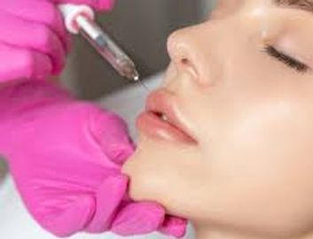 Lip Injections