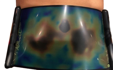 The Adicell Thermographic Analysis create the only system that targets and treats the entire body.