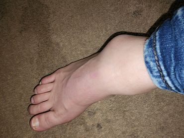 A bare foot on a carpeted floor, wearing blue jeans.