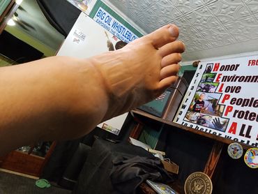 A close-up of a foot with a motivational poster in the background.