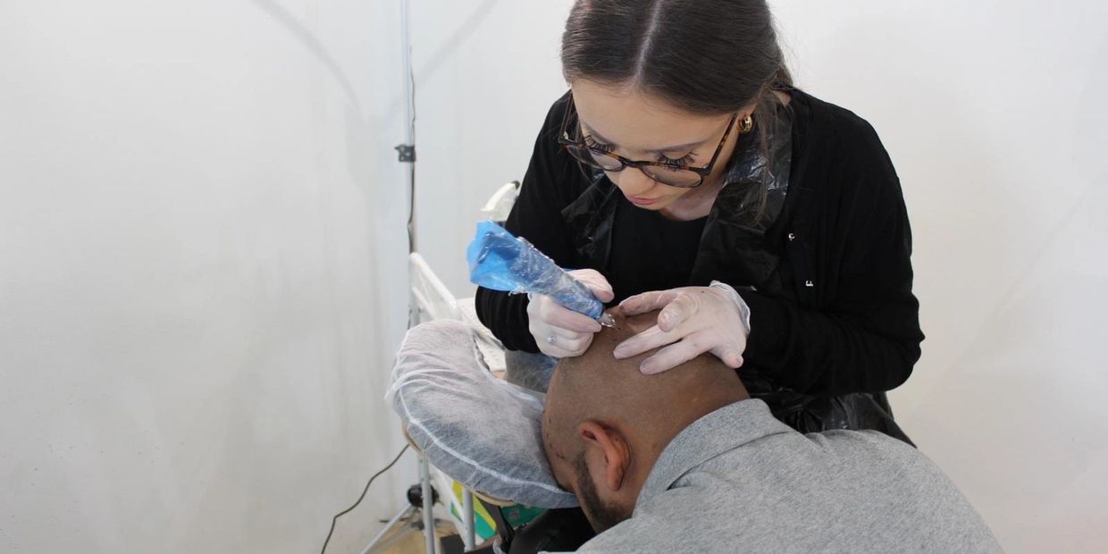 Scalp Micropigmentation Treatment. Hair Loss Solution. Hairline Tattoo. Hair Transplant Alternative.