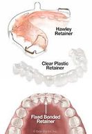 retainers given after orthodontic treatment. Orthodontic treatment is needs retention for stability