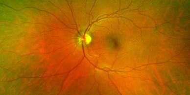 We offer Optomap Retinal Imaging.