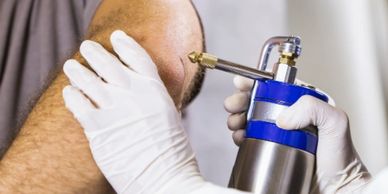 Tratamento de lesão no braço de um homem por crioterapia