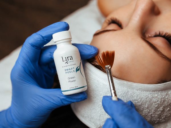 Chemical peel at Solo Esthetics And Skin Spa, Sterling VA