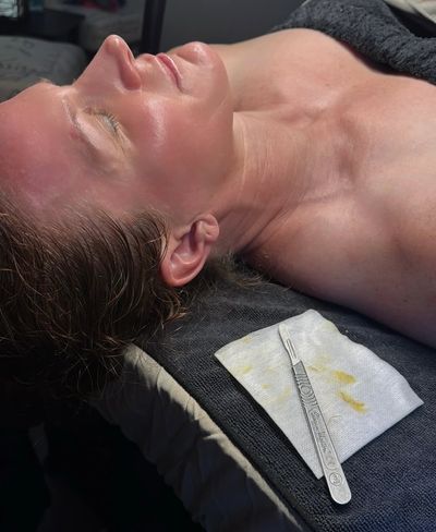 Professional dermaplaning facial treatment at Tru U Esthetix in Franklin, TN showing sterile blade a