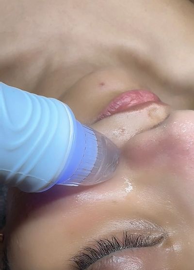 Hydrofacial treatment in Franklin TN at Tru U Esthetix