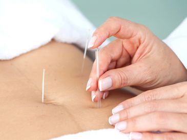 Abdominal and belly button acupuncture