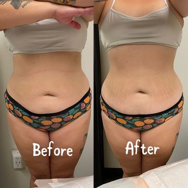 before and after images