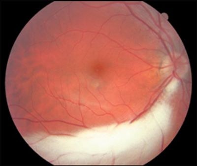 Myelinated nerve fiber