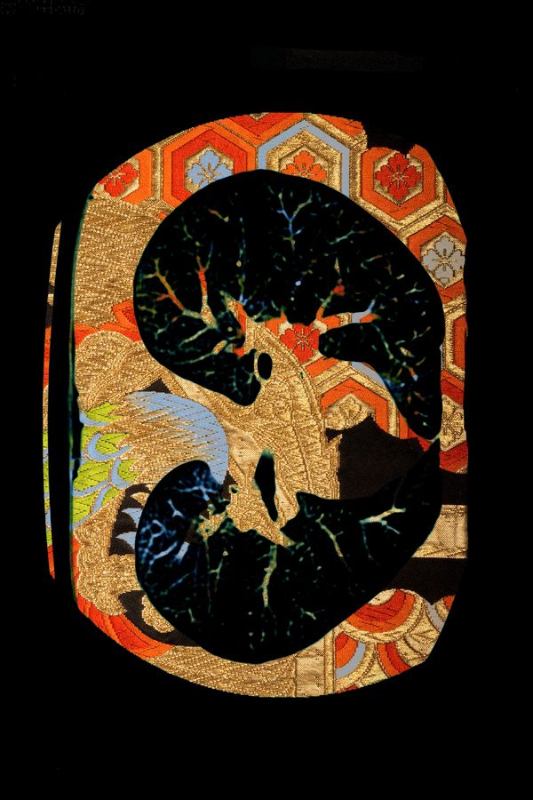 That's hip from an MRI scan with a Japanese obi silk in the second layer. 