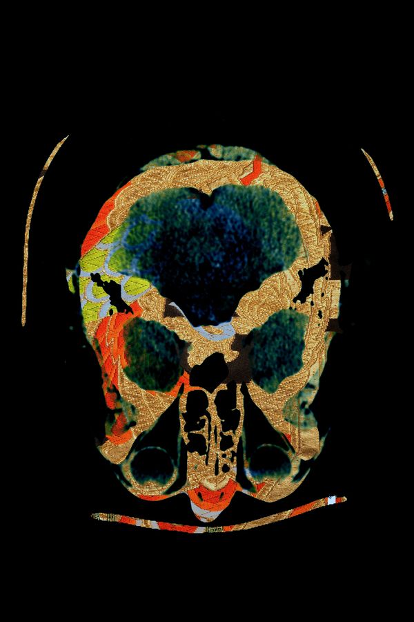 Self Portrait: Head, 800mm x 600mm, 2020. Head scan x-ray over Japanese silk obi (kimono belt). Prin