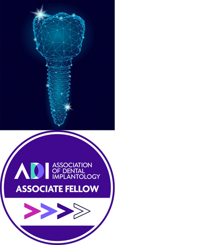 Dental Implant Scotland