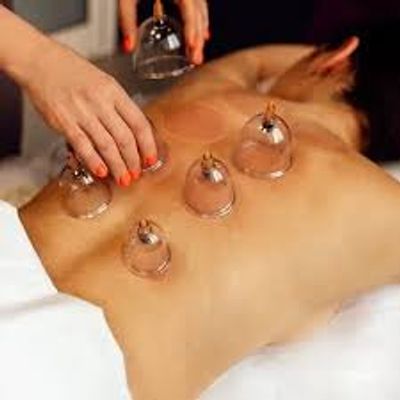 Person receiving cupping therapy on their back with several glass cups.