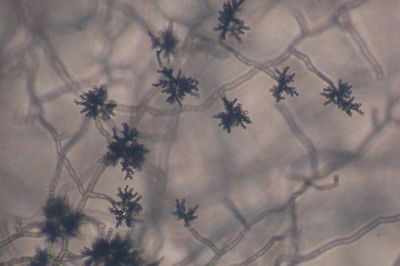 Cladosporium - can grow in any temperature and is found in basements, attics, and under sinks.