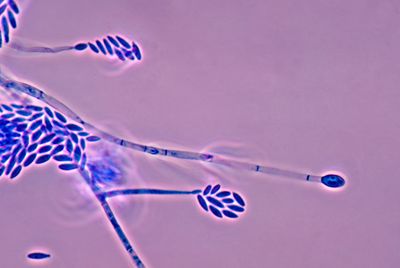 Fusarium - An allergenic toxic mold that can grow in homes with water damage in carpeting, wallpaper