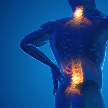 3D illustration of a person with highlighted spinal pain areas.