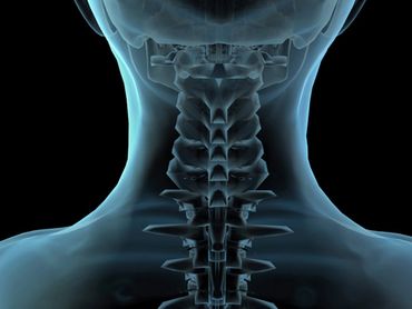 Image representation of bones