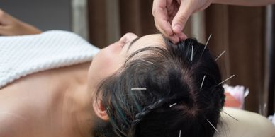 natural remedies for stroke parkinson brain neurological acupuncture
