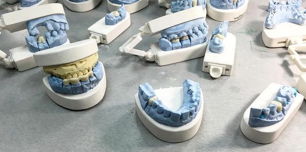 Crowns and Bridges Dental Lab Miami