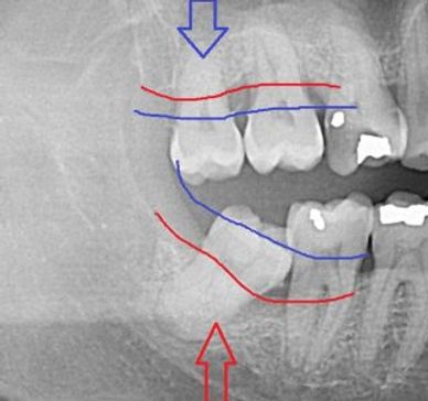 Watertown Oral Surgery