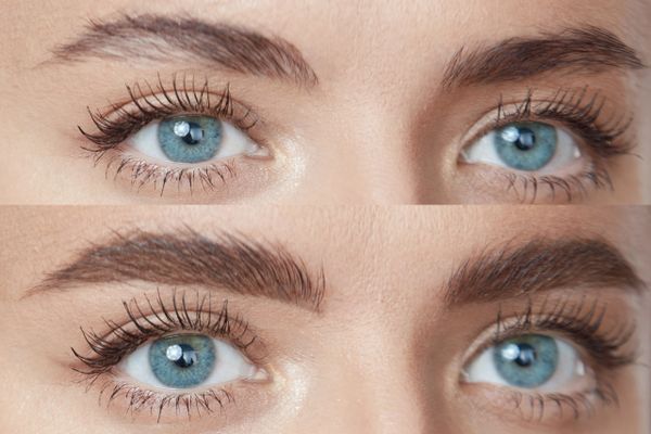 Eyebrow before and after